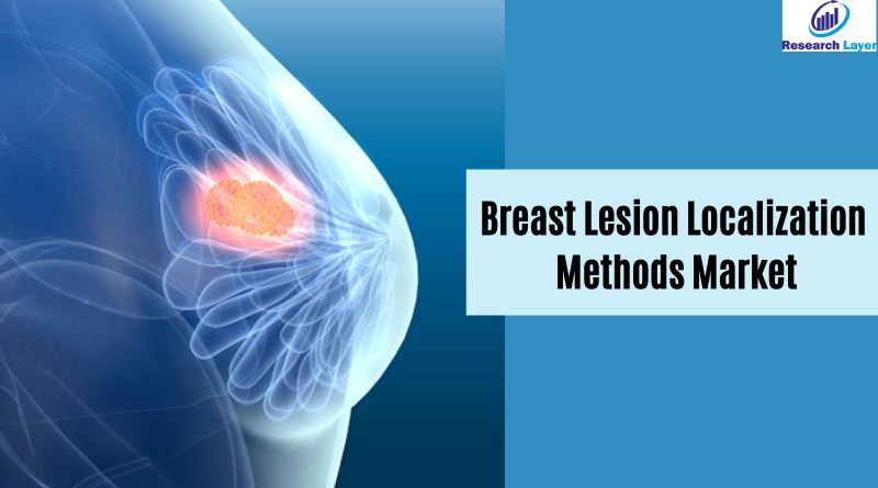 Breast Lesion Localization Methods Market