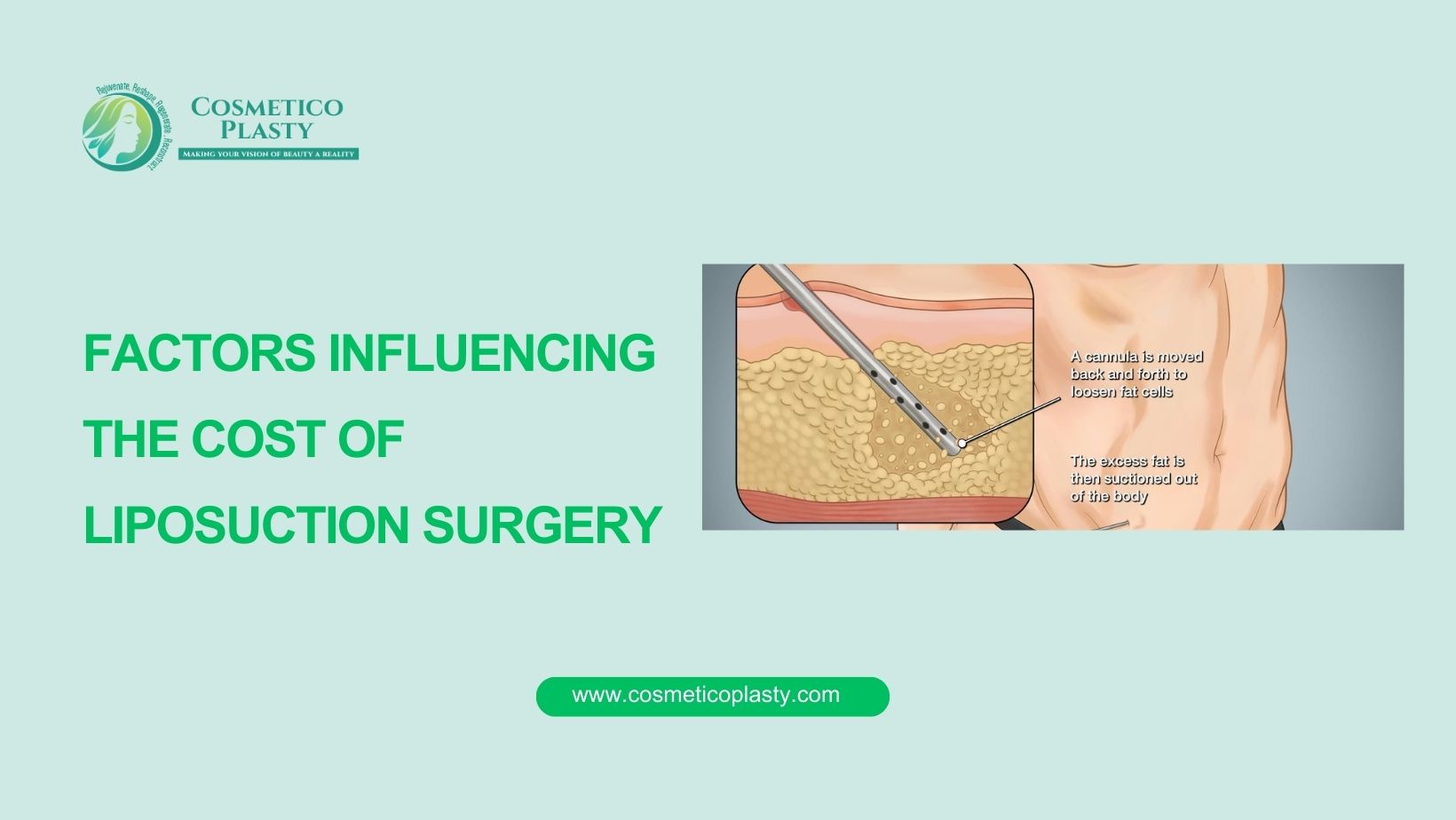 Factors influencing the cost of liposuction surgery